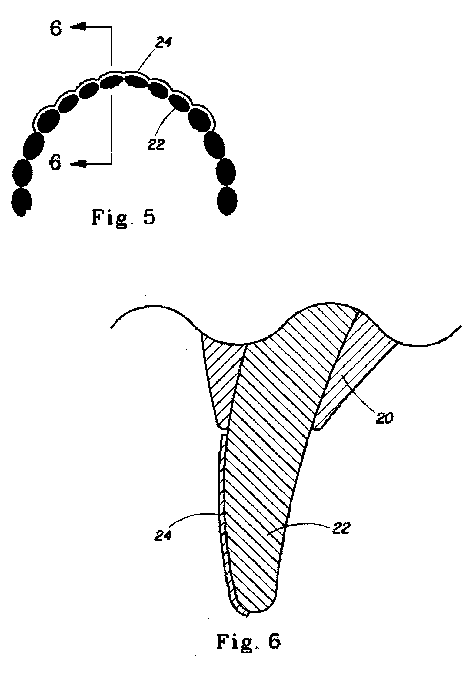 Emulsion composition for delivery of bleaching agents to teeth