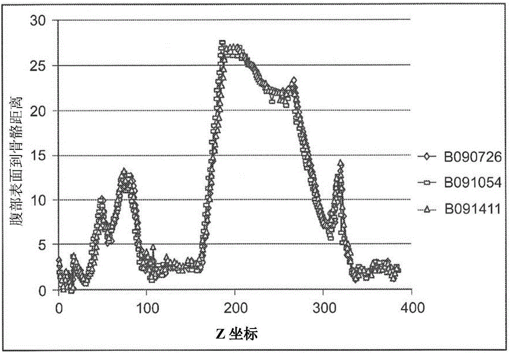 Method and system for automated detection of tissue interior to a mammalian ribcage from an in vivo image