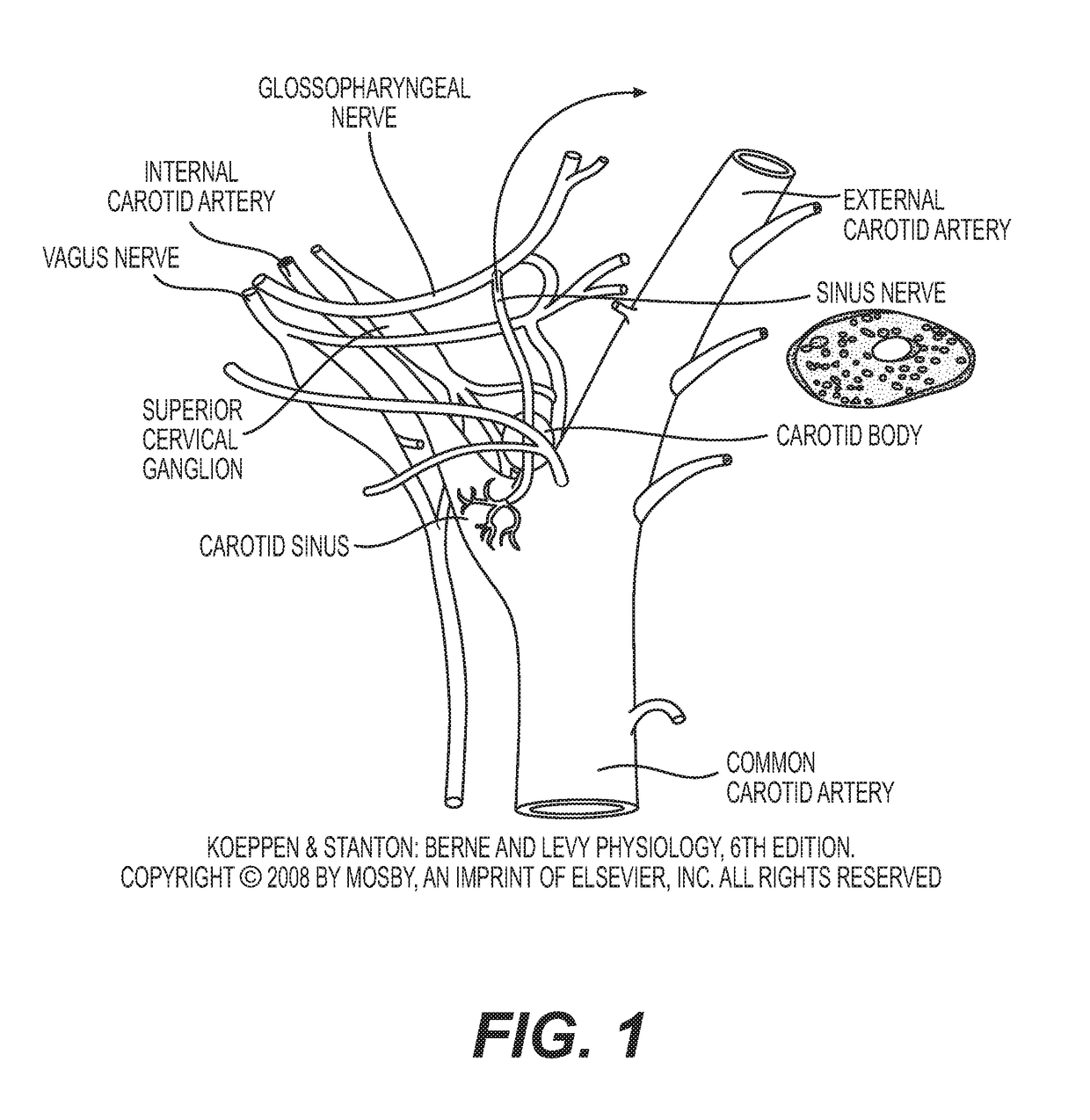 Neuromodulation device