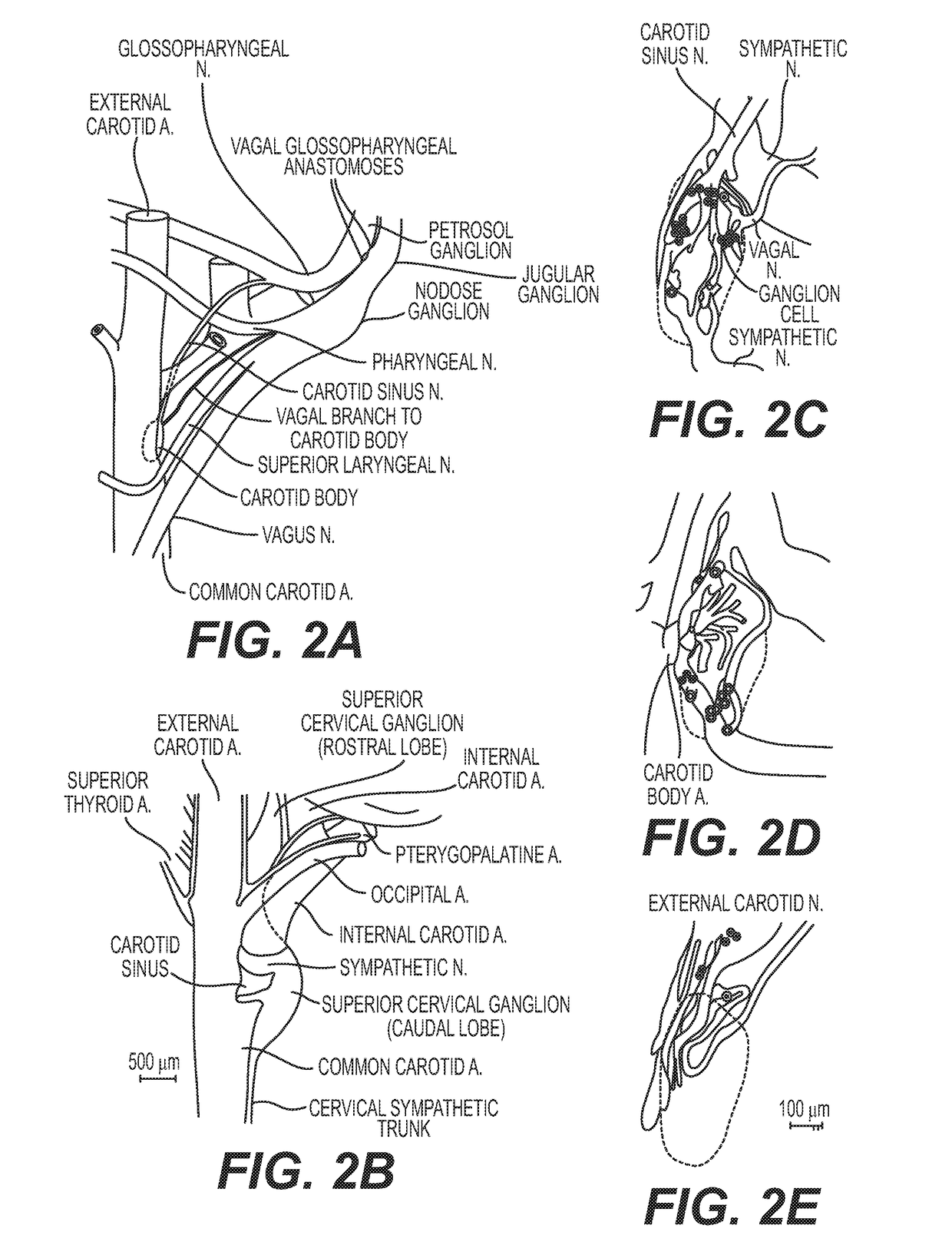 Neuromodulation device