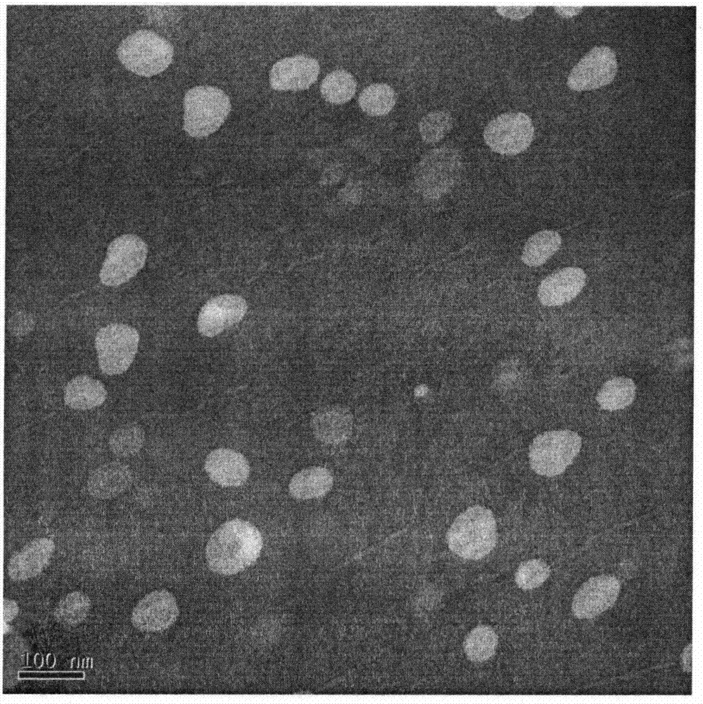 Preparation method of temperature response type nanoliposomes coated with matrix metalloproteinase inhibitors