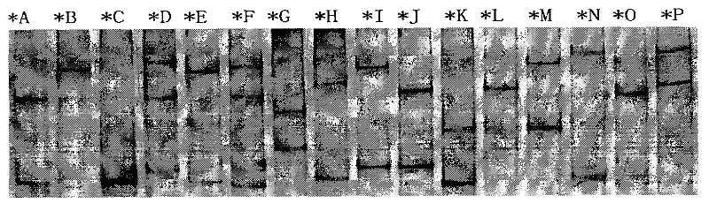 Special amplimer for detecting tibetan sheep foot rot resistance allele, detecting agent case and method thereof