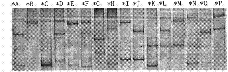 Special amplimer for detecting tibetan sheep foot rot resistance allele, detecting agent case and method thereof