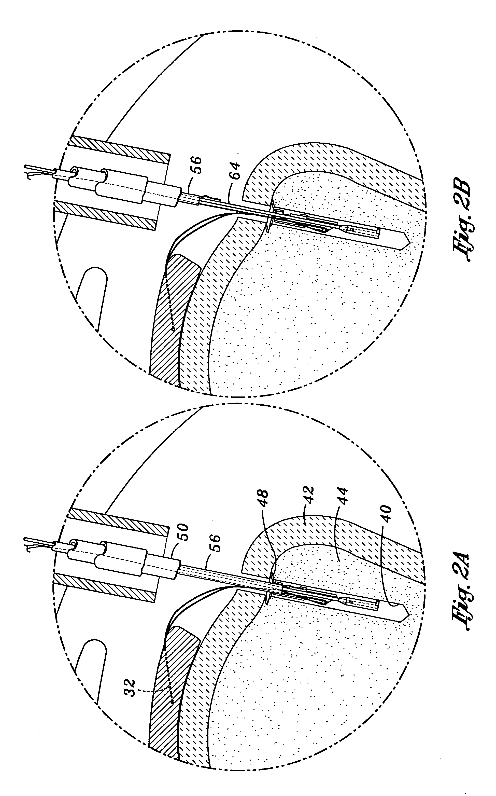 Knotless suture lock apparatus and method for securing tissue