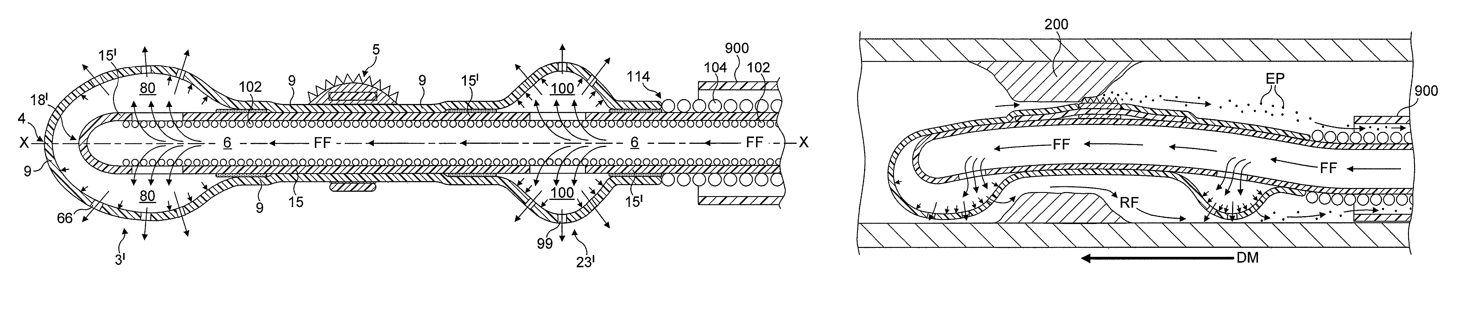 Rotational atherectomy device with fluid inflatable support elements and distal protection capability