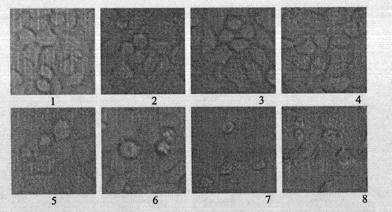 Giant panda ribosomal subunit gene RPL23a recombinant protein and application thereof in preparing anti-cancer drugs