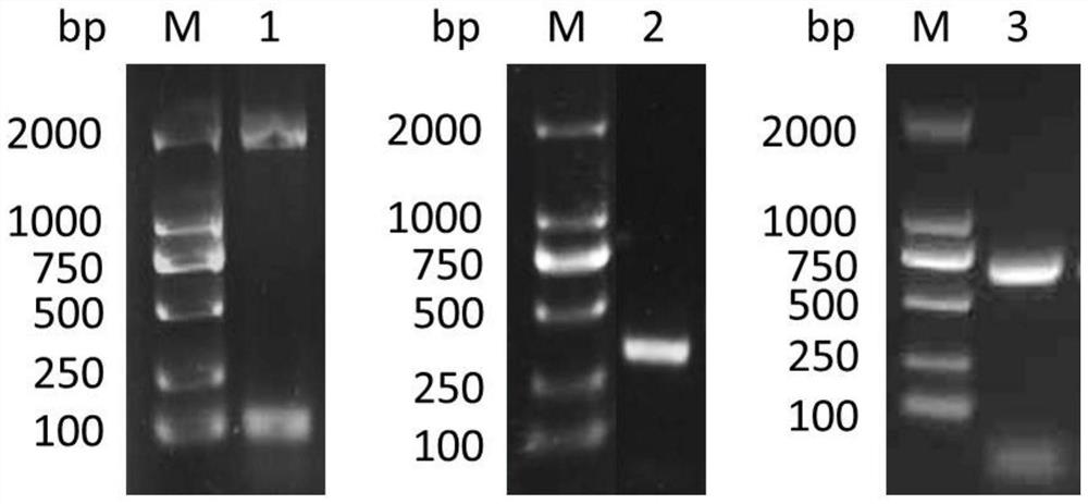 Schistosoma japonicum antigen protein rSjScP92 and application thereof