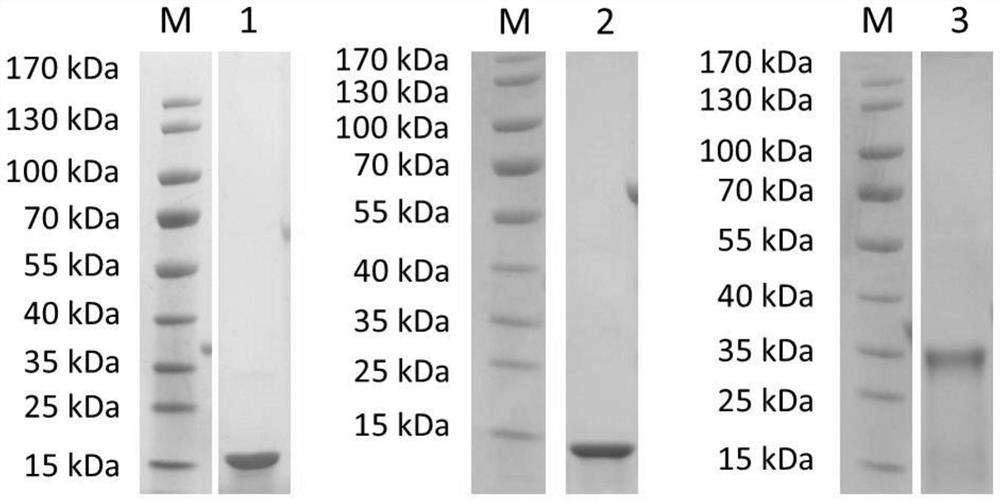 Schistosoma japonicum antigen protein rSjScP92 and application thereof