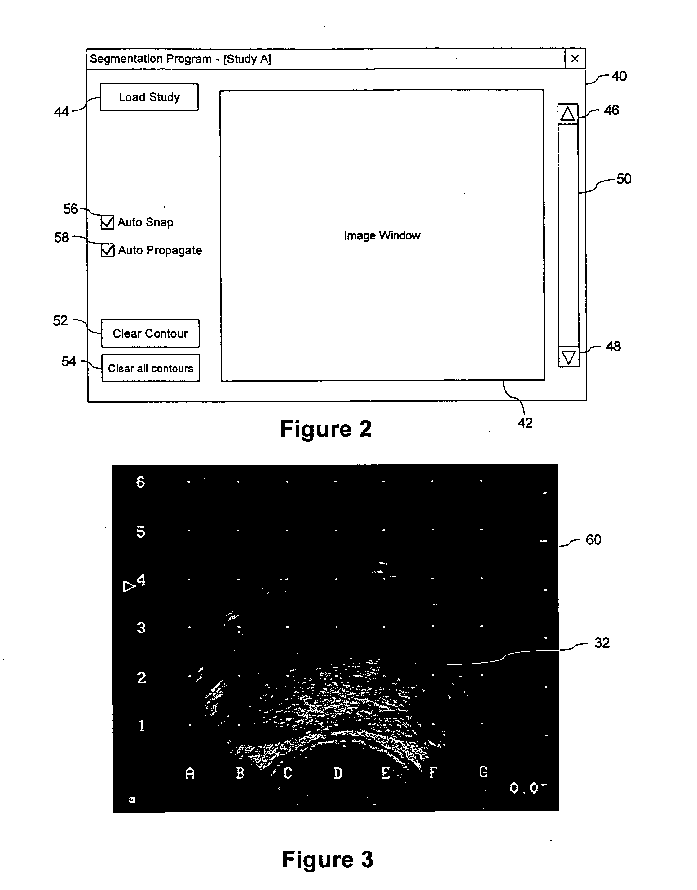 System and Method for Segmenting a Region in a Medical Image
