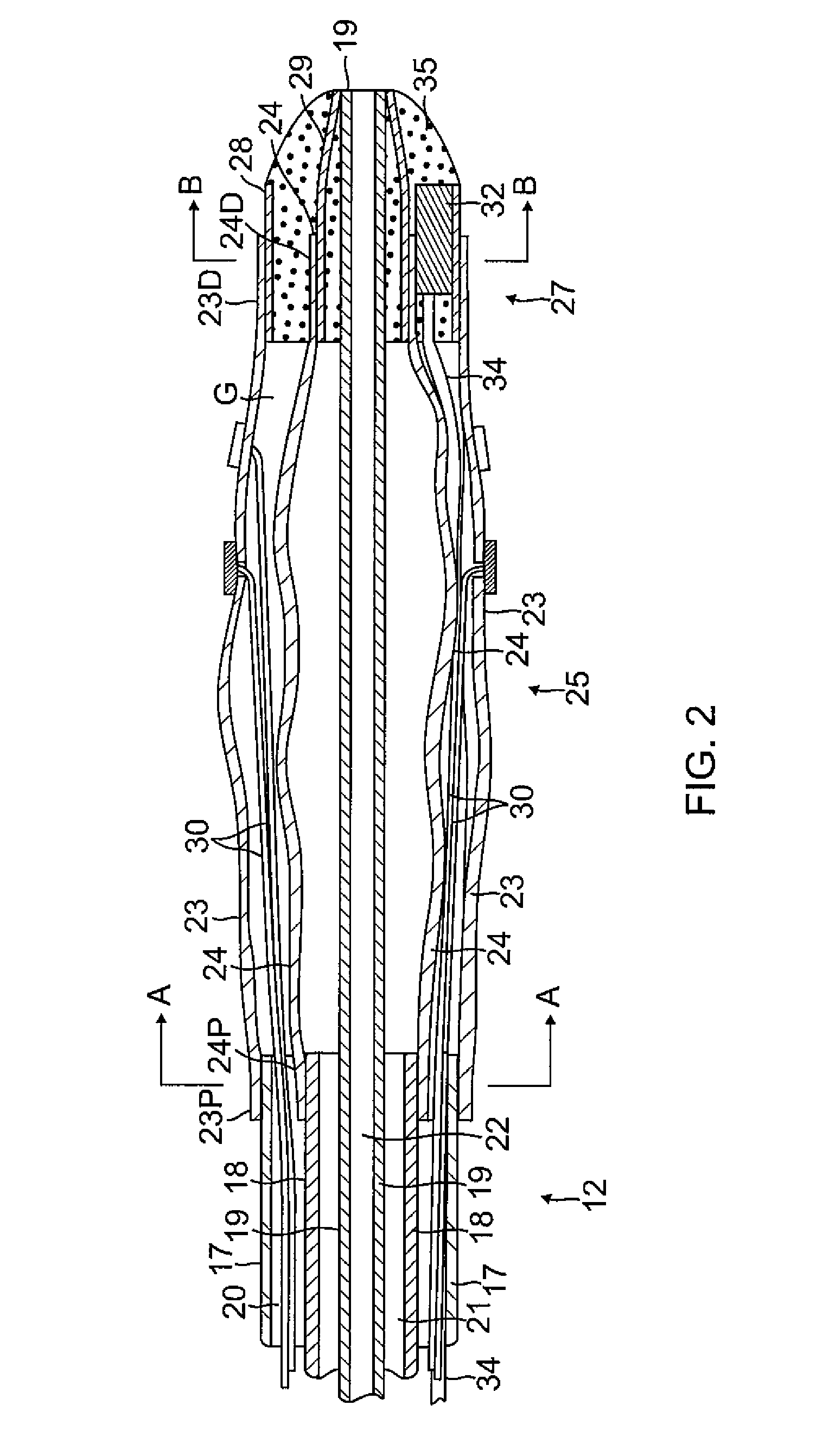 Multi-electrode balloon catheter with circumferential and point electrodes