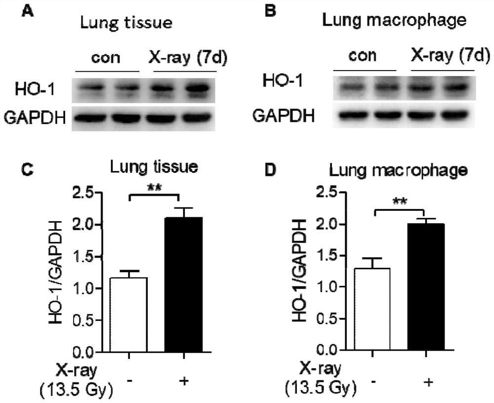 Application of heme oxygenase-1 in diagnosis and treatment of radiation-induced lung injury