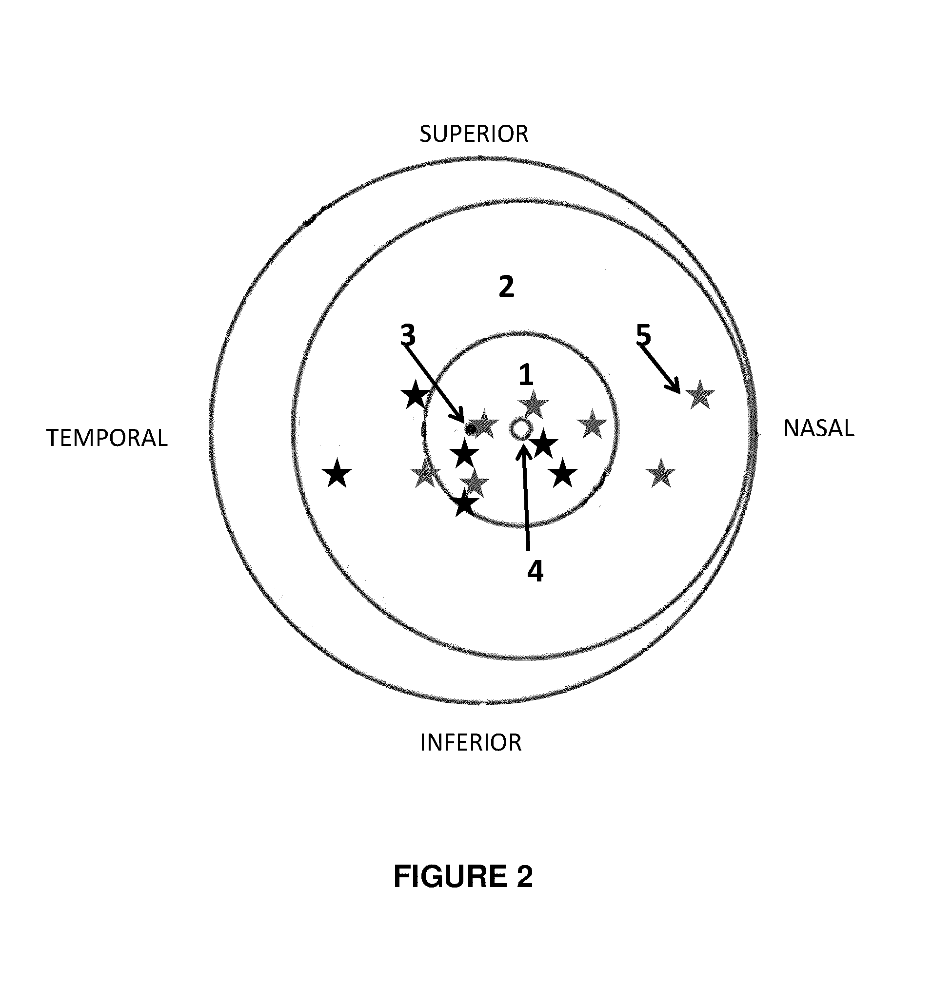 Method and system for imaging amyloid beta in the retina of the eye in association with alzheimer's disease