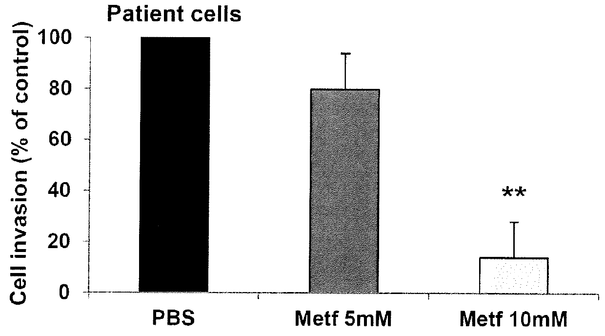 Methods and Compositions for Preventing Metastasis and for Improving the Survival Time