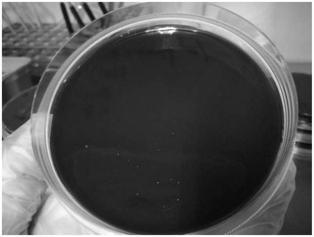 Culture medium for primary isolation of porphyromonas gingivalis as well as preparation method and application of culture medium