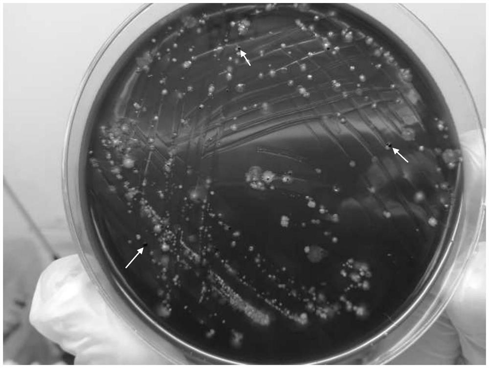 Culture medium for primary isolation of porphyromonas gingivalis as well as preparation method and application of culture medium