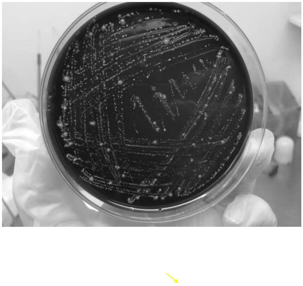 Culture medium for primary isolation of porphyromonas gingivalis as well as preparation method and application of culture medium