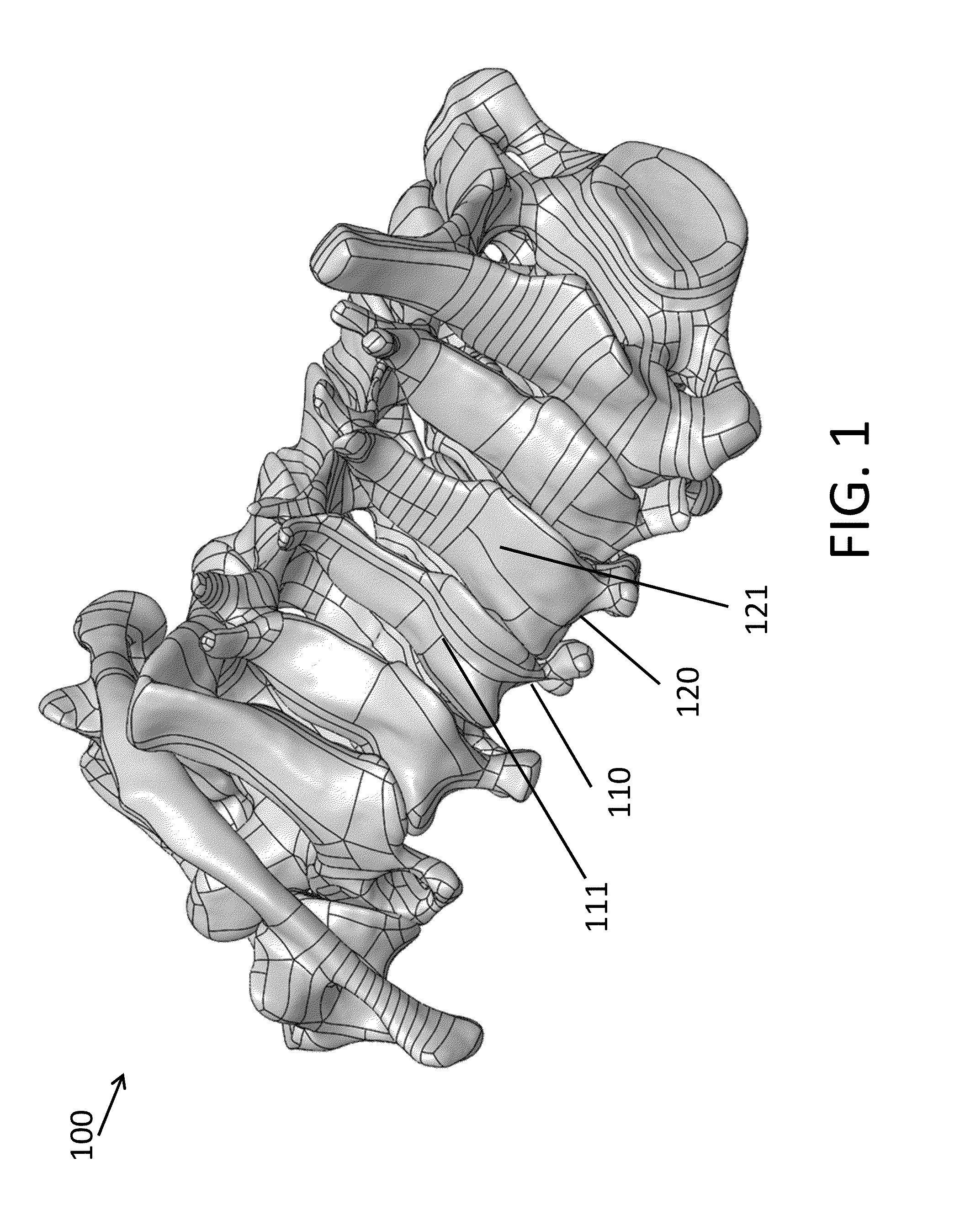 System and method for spinal fusion