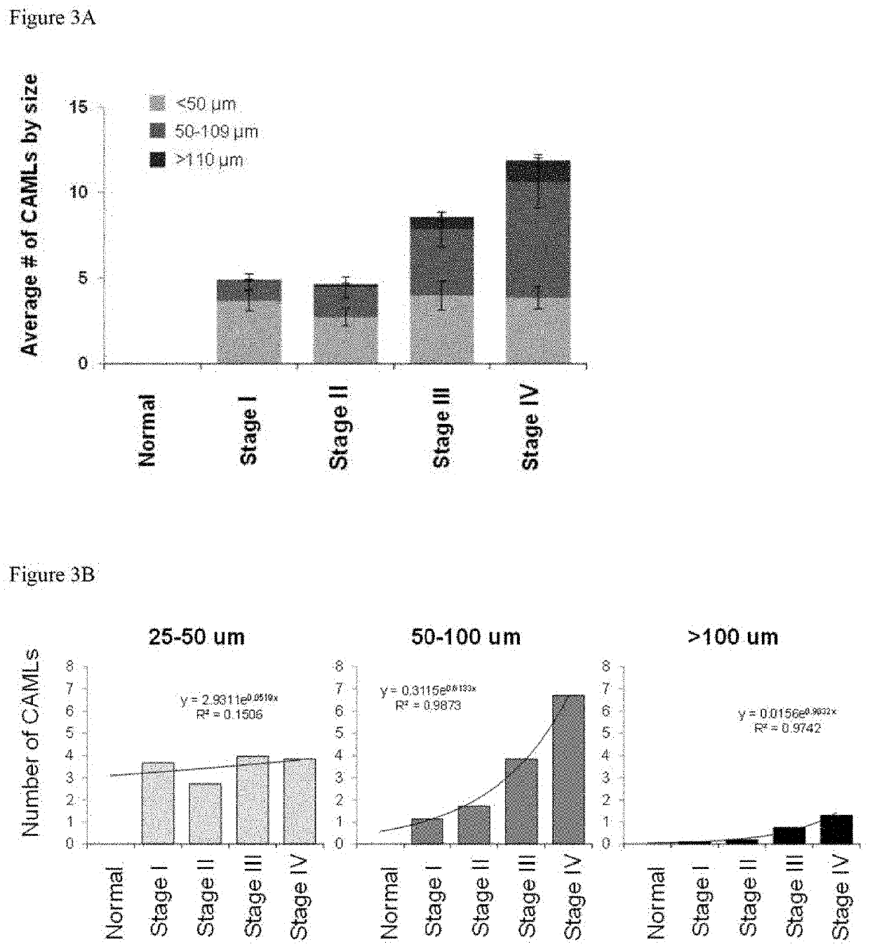 Methods for predicting overall and progression free survival in subjects having cancer using circulating cancer associated macrophage-like cells (CAMLS)