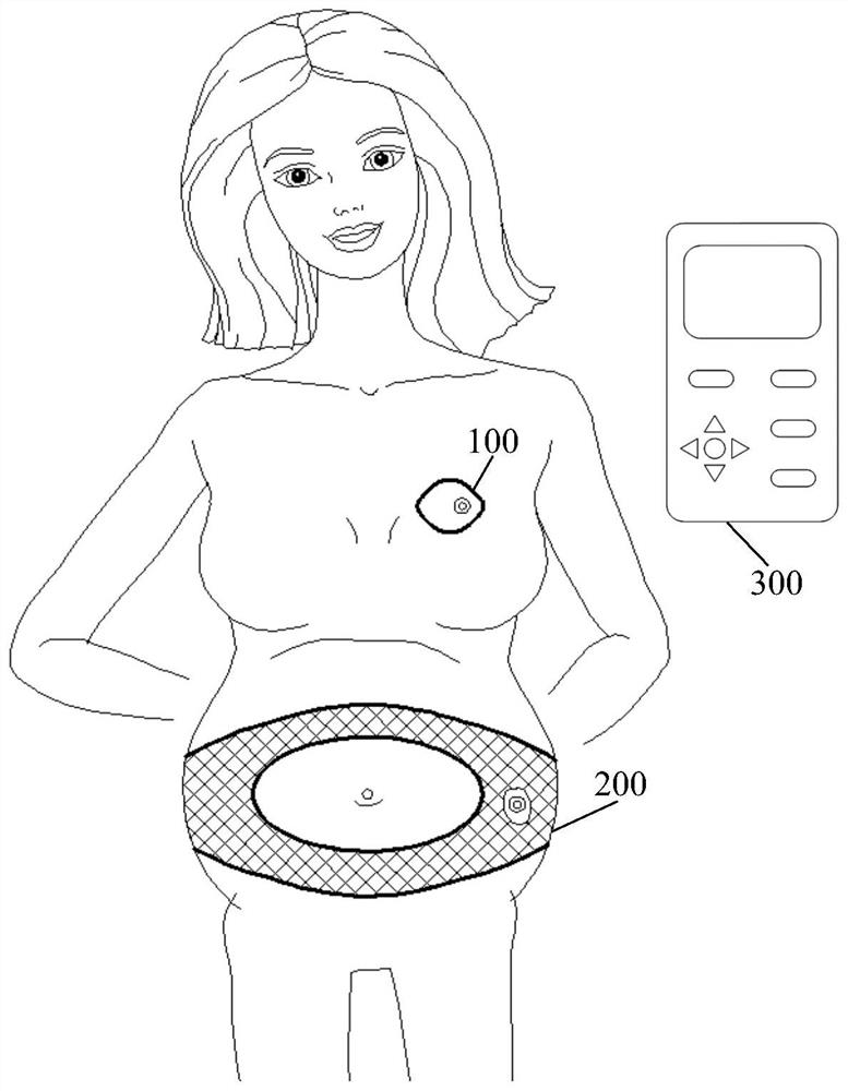 A fetal health monitor based on multi-channel passive signal acquisition