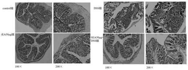 Application of SEA in preparation of drugs for treating inflammatory bowel diseases and biomarker for detecting curative effect of inflammatory bowel diseases