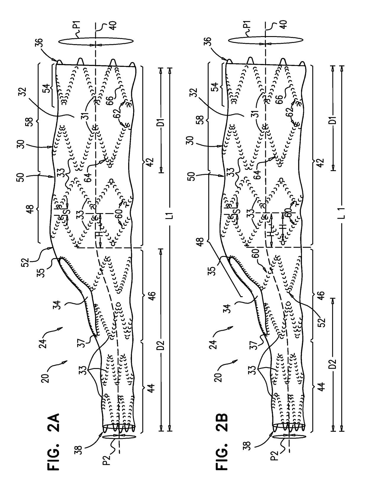 Multi-component stent-graft system for aortic dissections