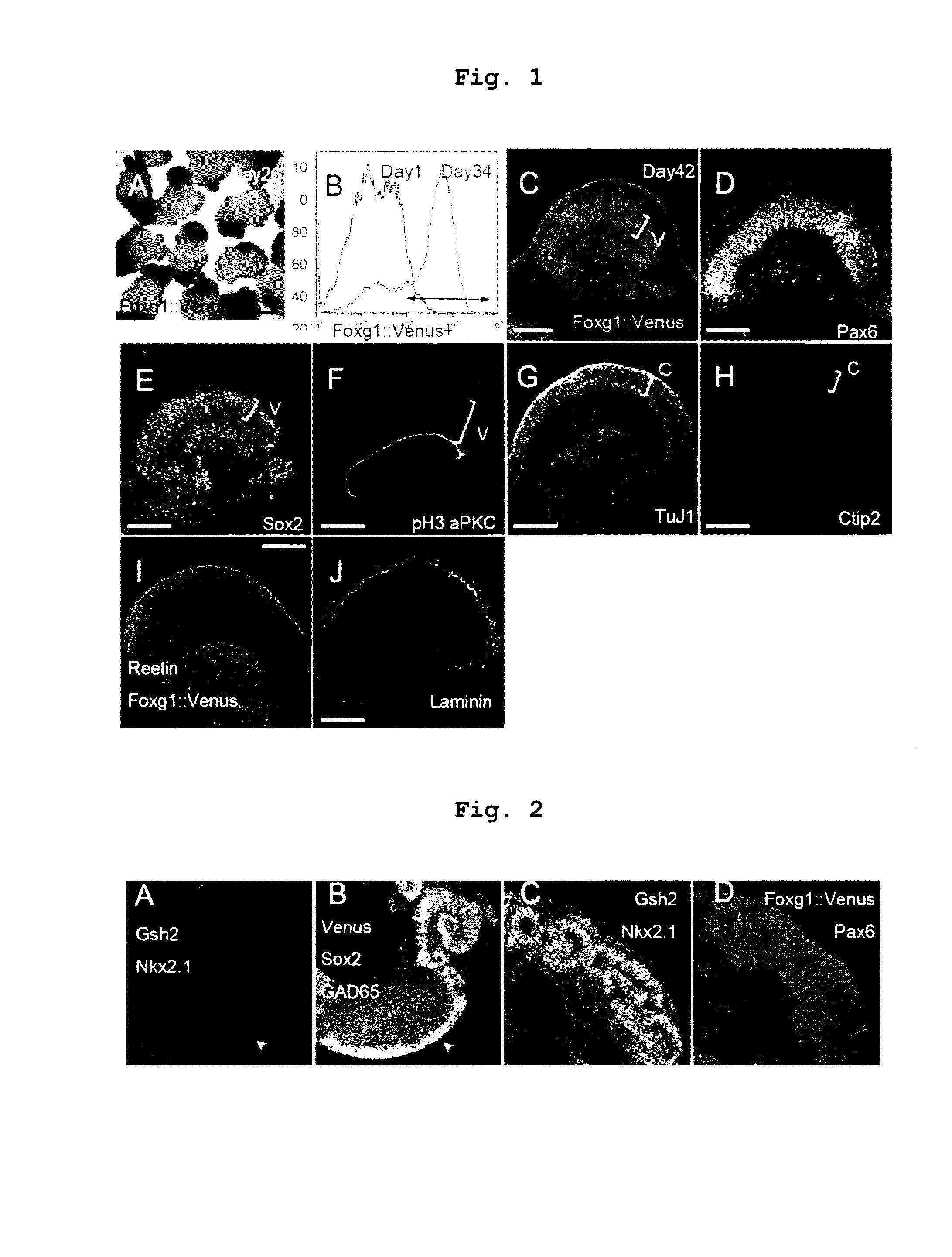 Method for manufacturing telencephalon or progenitor tissue thereof