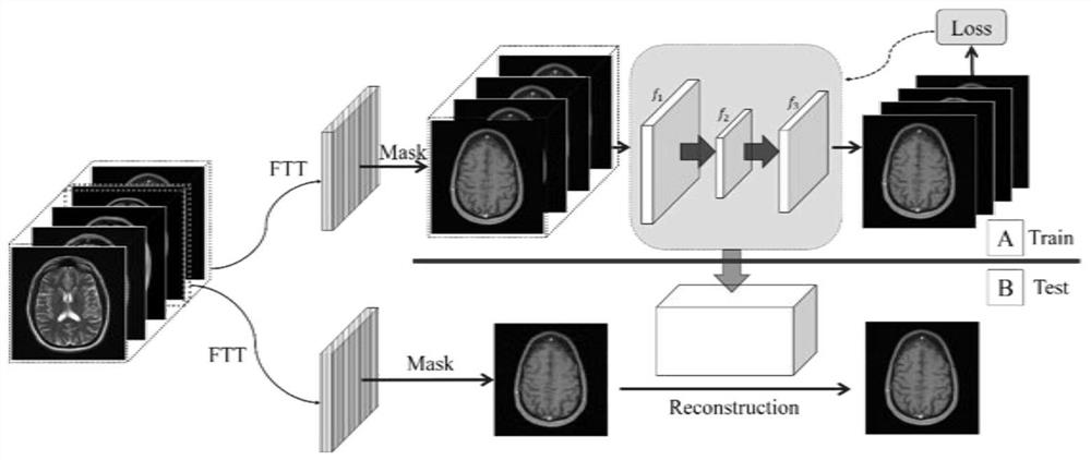 Optimized regularization and CNN-based undersampled magnetic resonance image high-performance reconstruction method