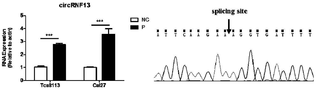 Application of reagents for promoting the expression of circular RNA circRNF13 in the preparation of drugs for the treatment of squamous cell carcinoma of the tongue