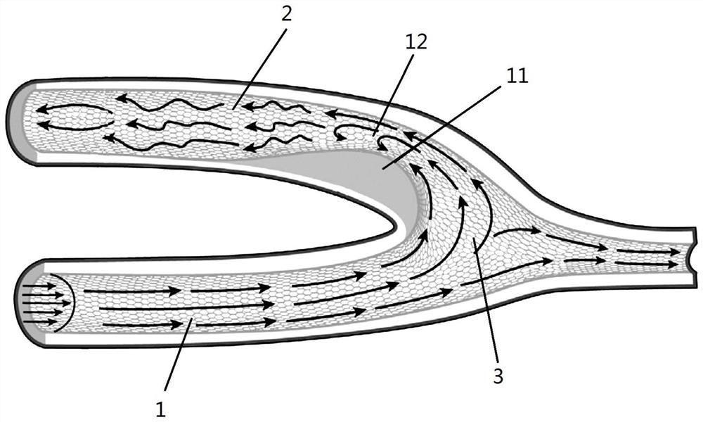 A medical intravascular implant device