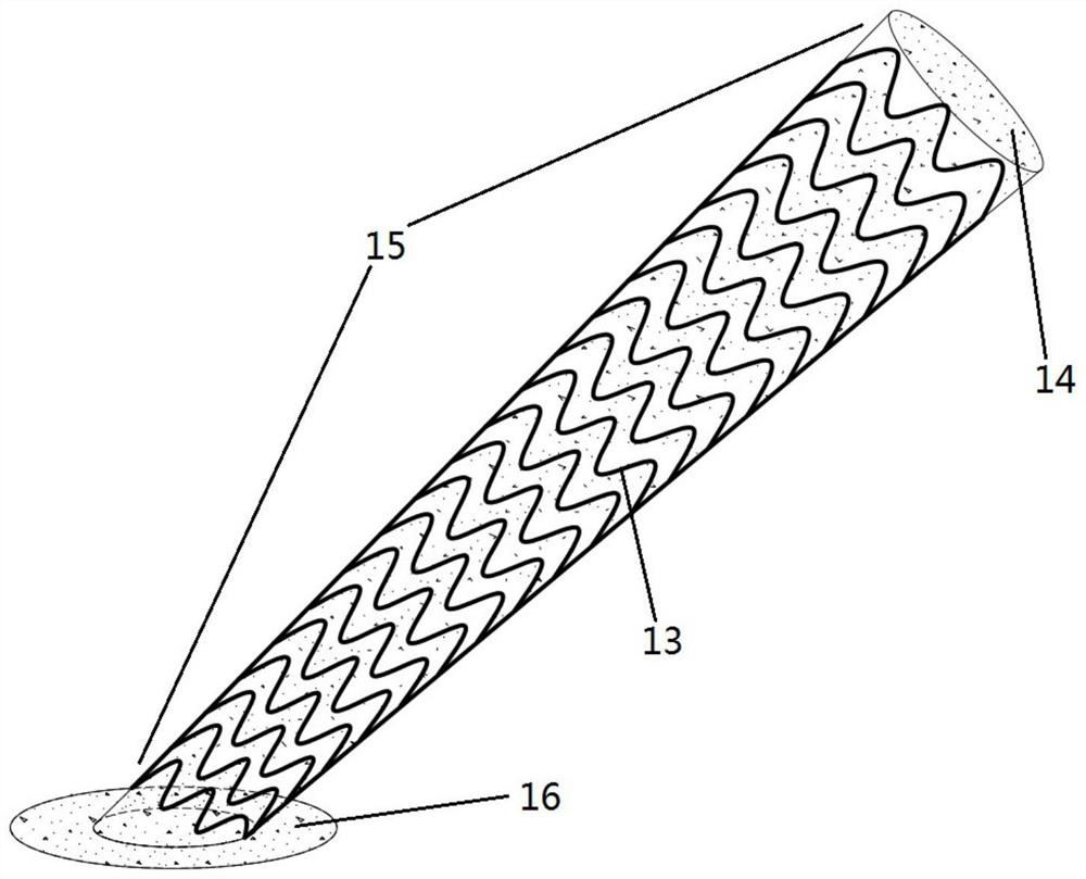 A medical intravascular implant device