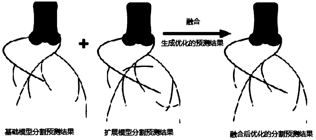 A network model segmentation method and device for a coronary artery