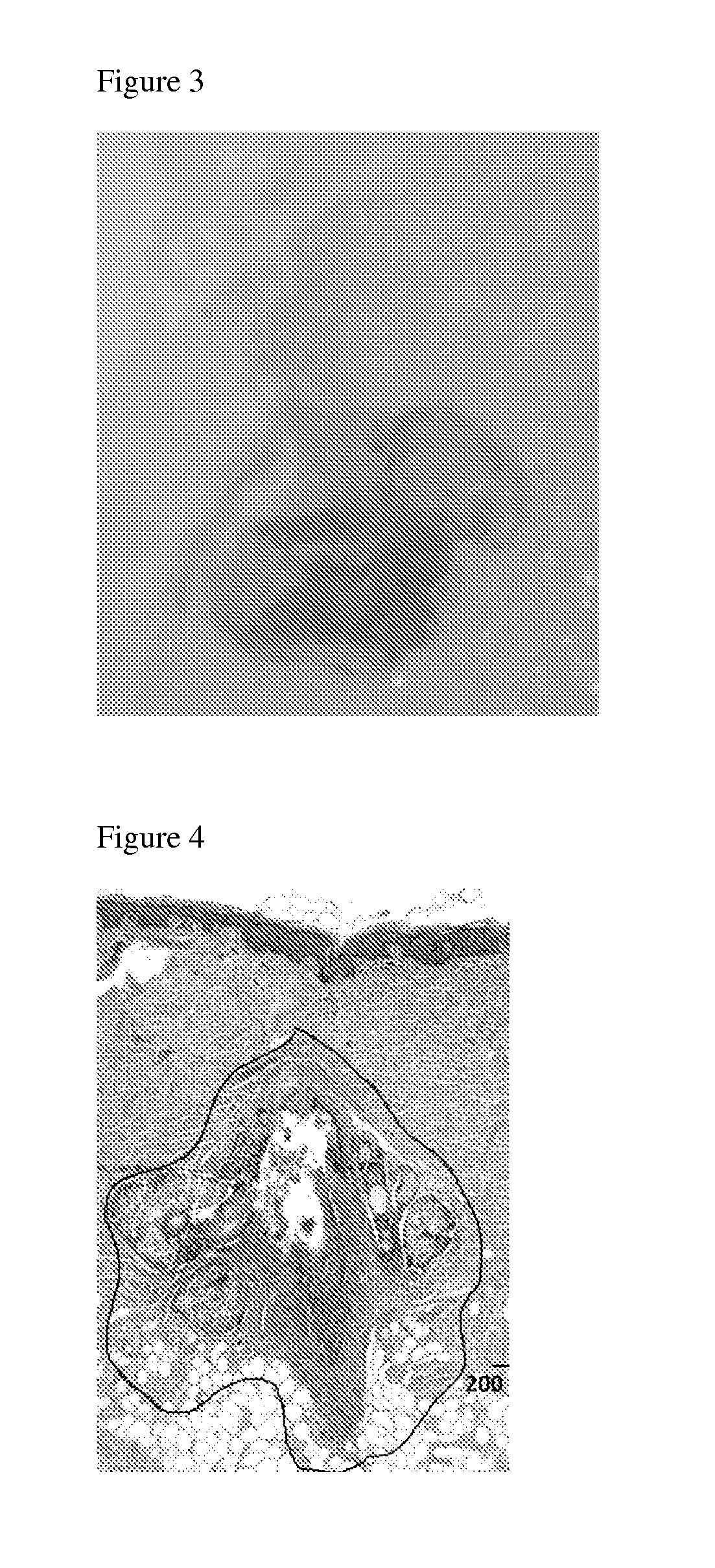 Compositions and methods comprising energy absorbing compoundfs for follicular delivery