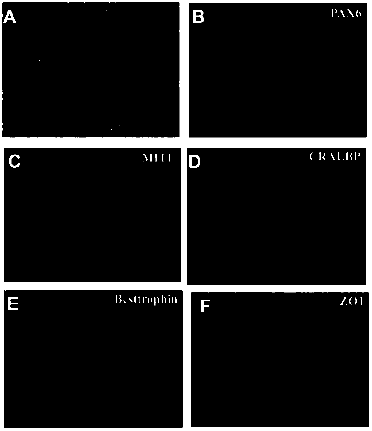 Method for inducing human embryonic stem cells to differentiate into retinal pigment epithelial cells in vitro
