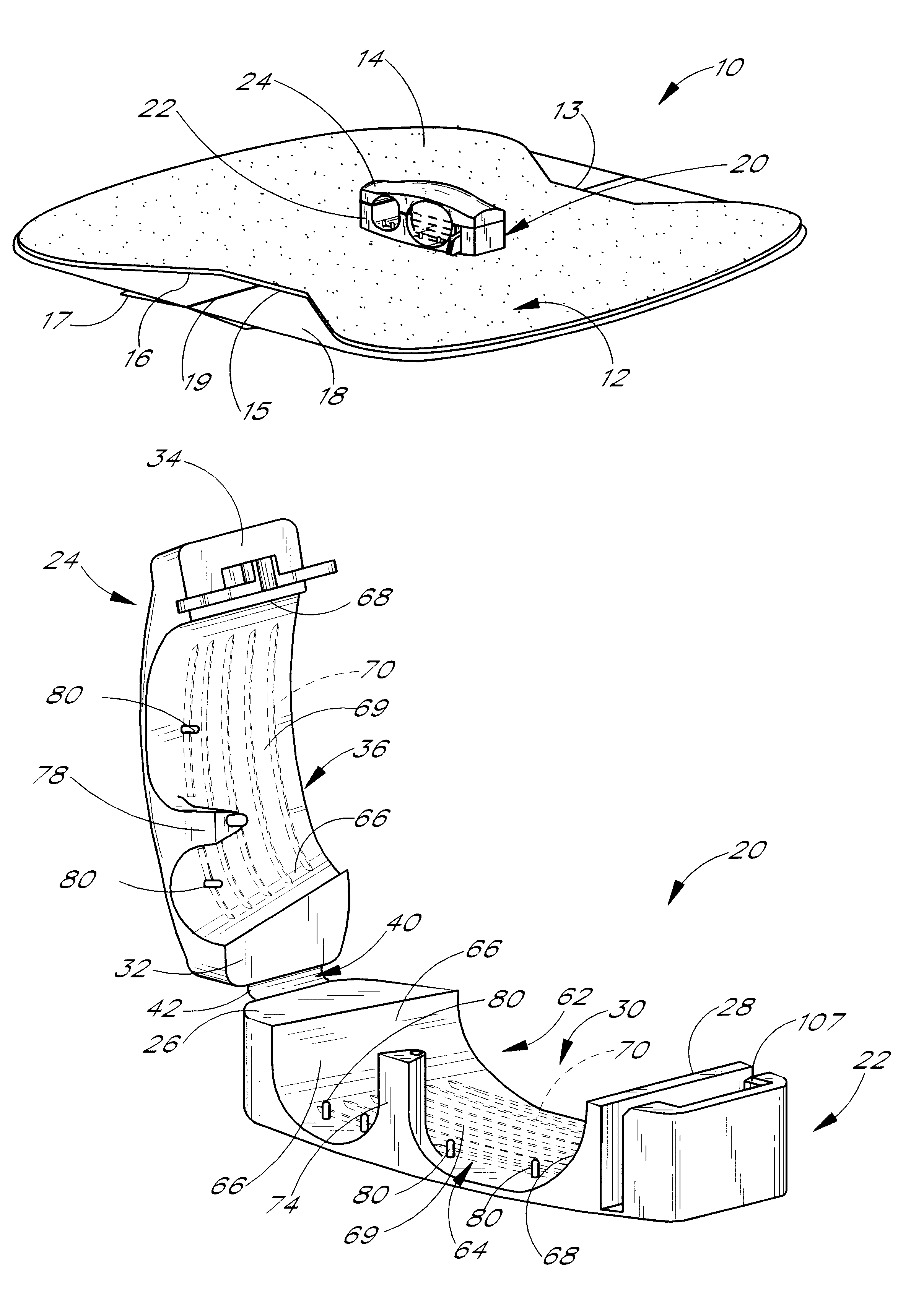 Anchoring system for a medical article