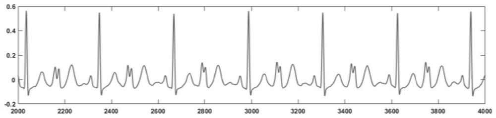 A blood pressure waveform monitoring method and device