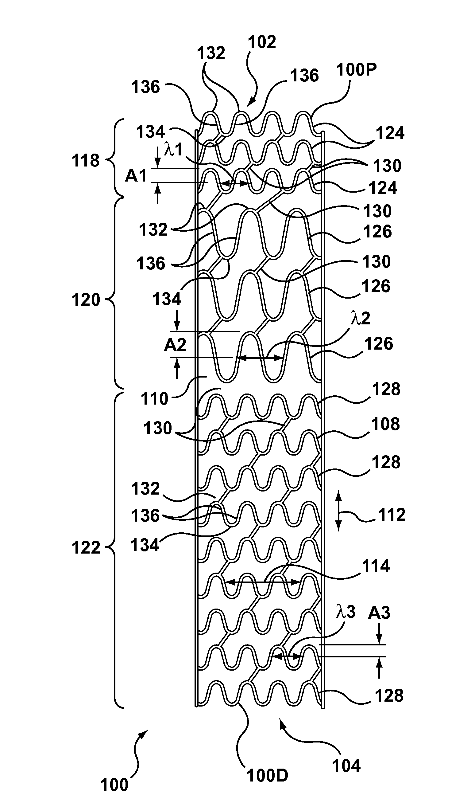Variable zone high metal to vessel ratio stent and method