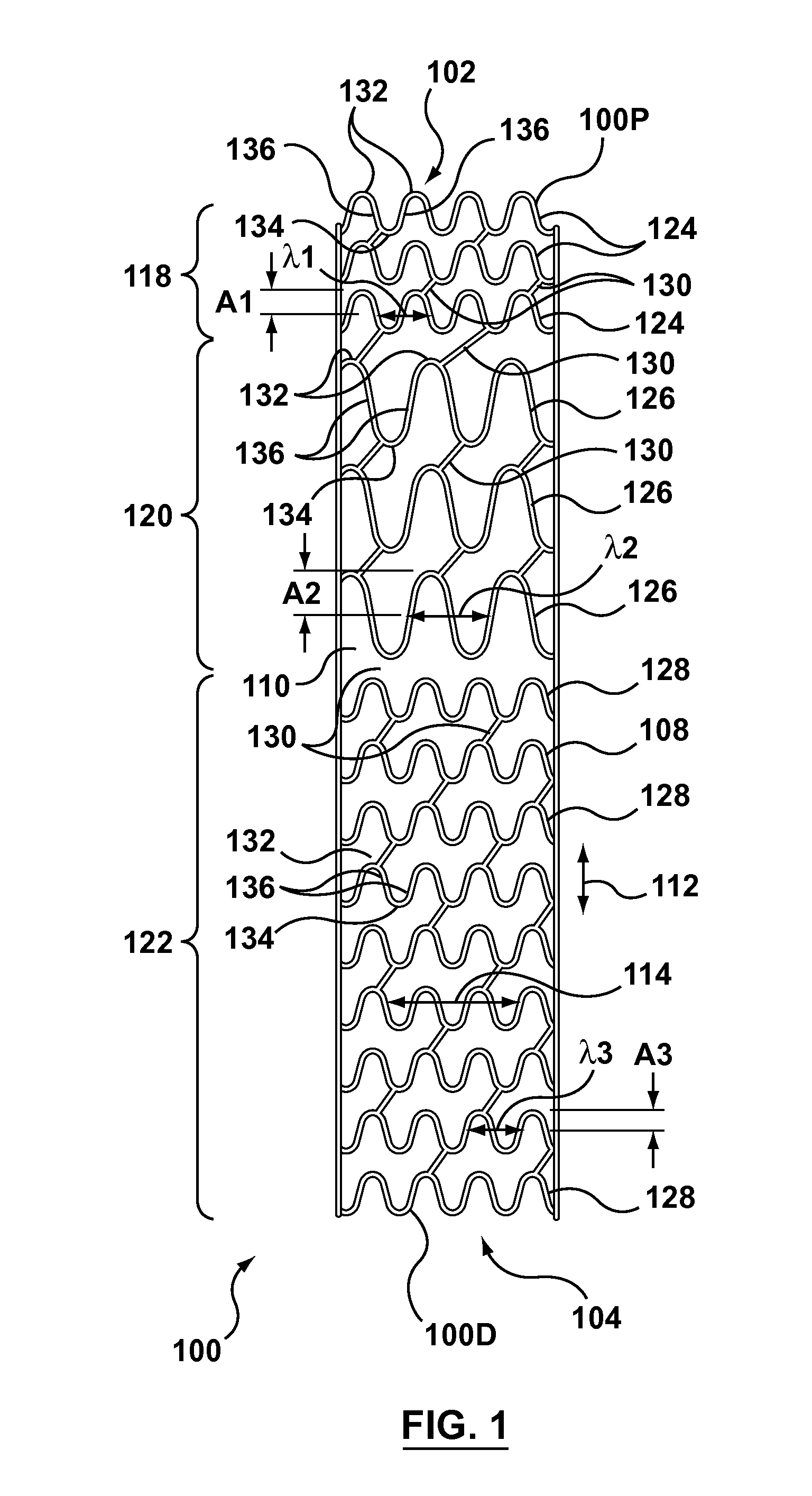 Variable zone high metal to vessel ratio stent and method
