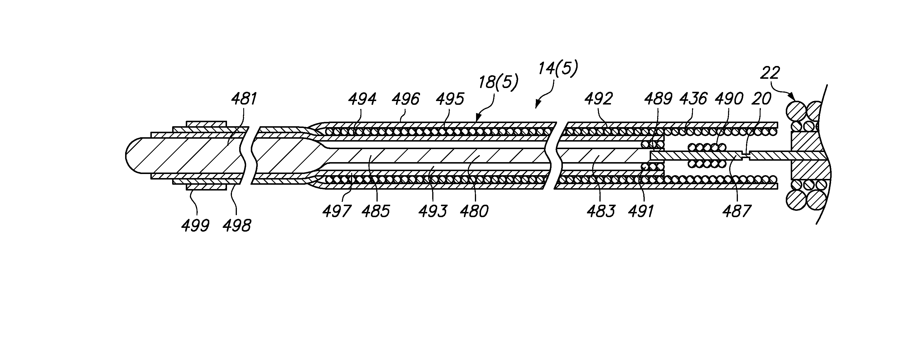 Medical implant detachment systems and methods
