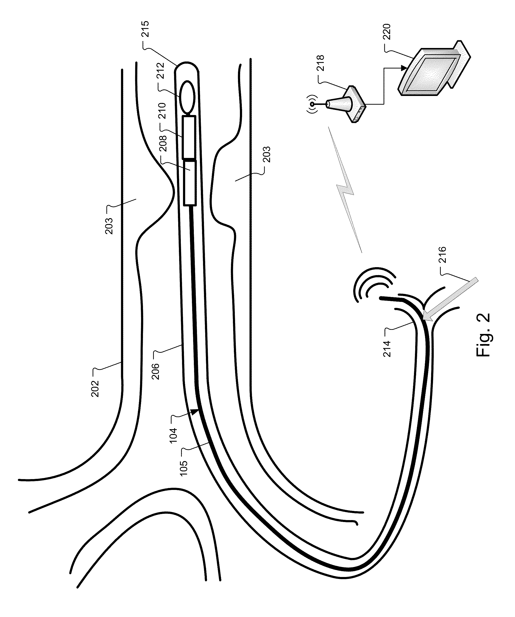 Wireless pressure wire system with integrated power