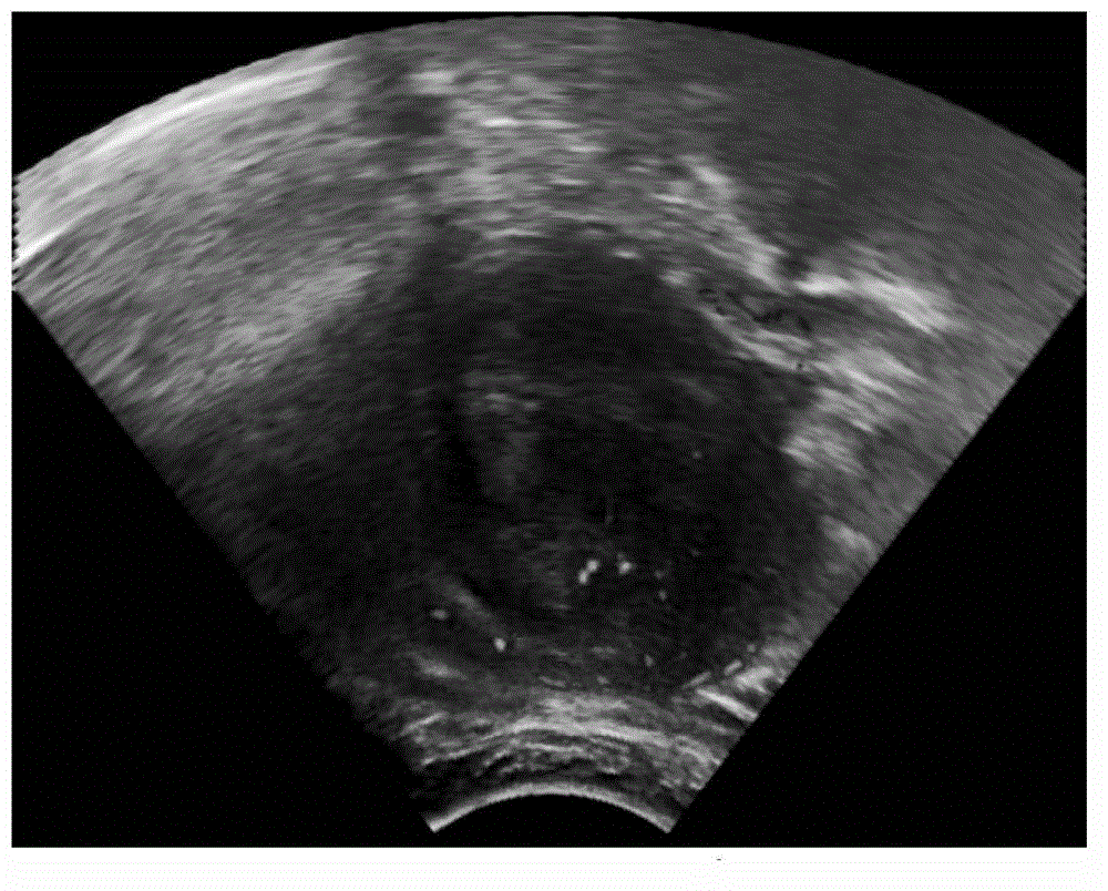 Ultrasound image/ultrasound video transmission method and device