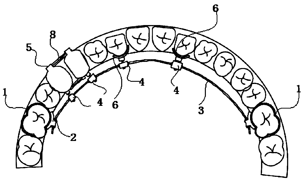 Orthodontics device