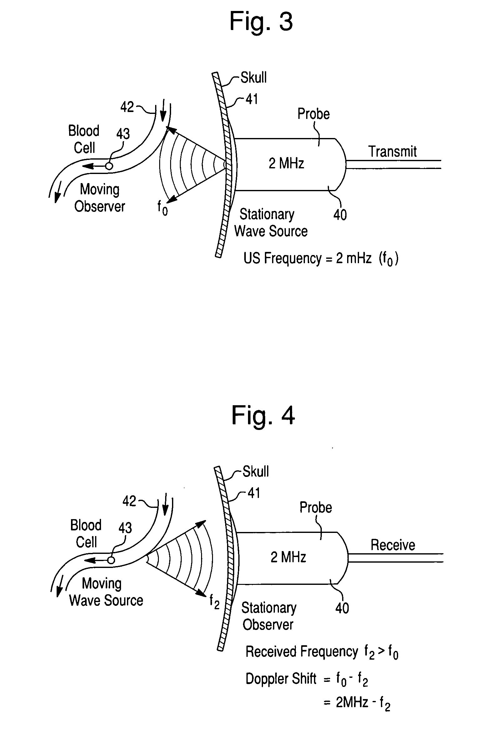 Systems and methods for using dynamic vascular assessment to distinguish among vascular states and for investigating intracranial pressure