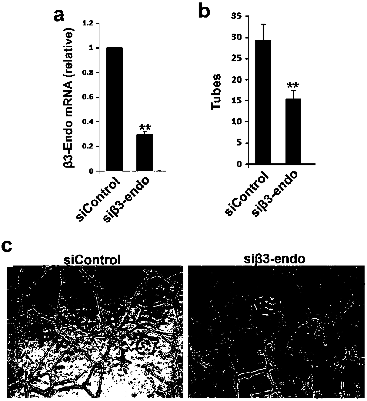 Application of beta 3-endoxine protein factor as target molecule in regulation of neovascularization