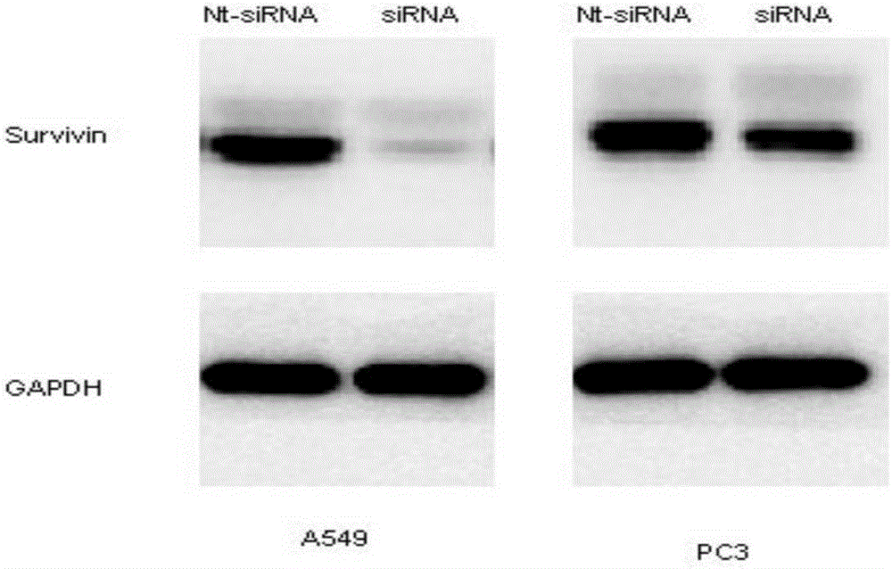 Double-strand siRNA inhibiting survivin gene expression, application thereof and expression plasmid and transfersome containing same
