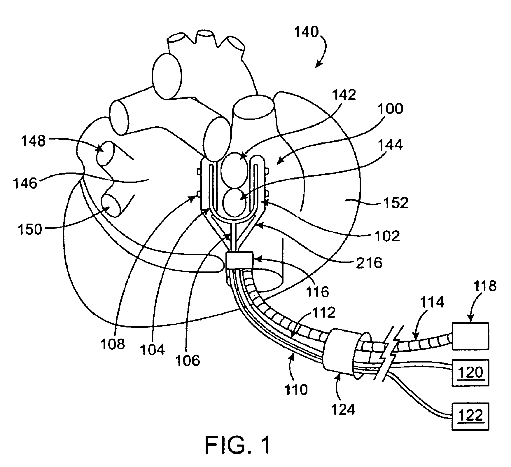 Conduction block verification probe and method of use