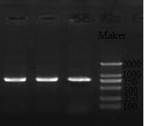 A kind of recombinant Periplaneta americana thymosin protein pathy1 and its expression method