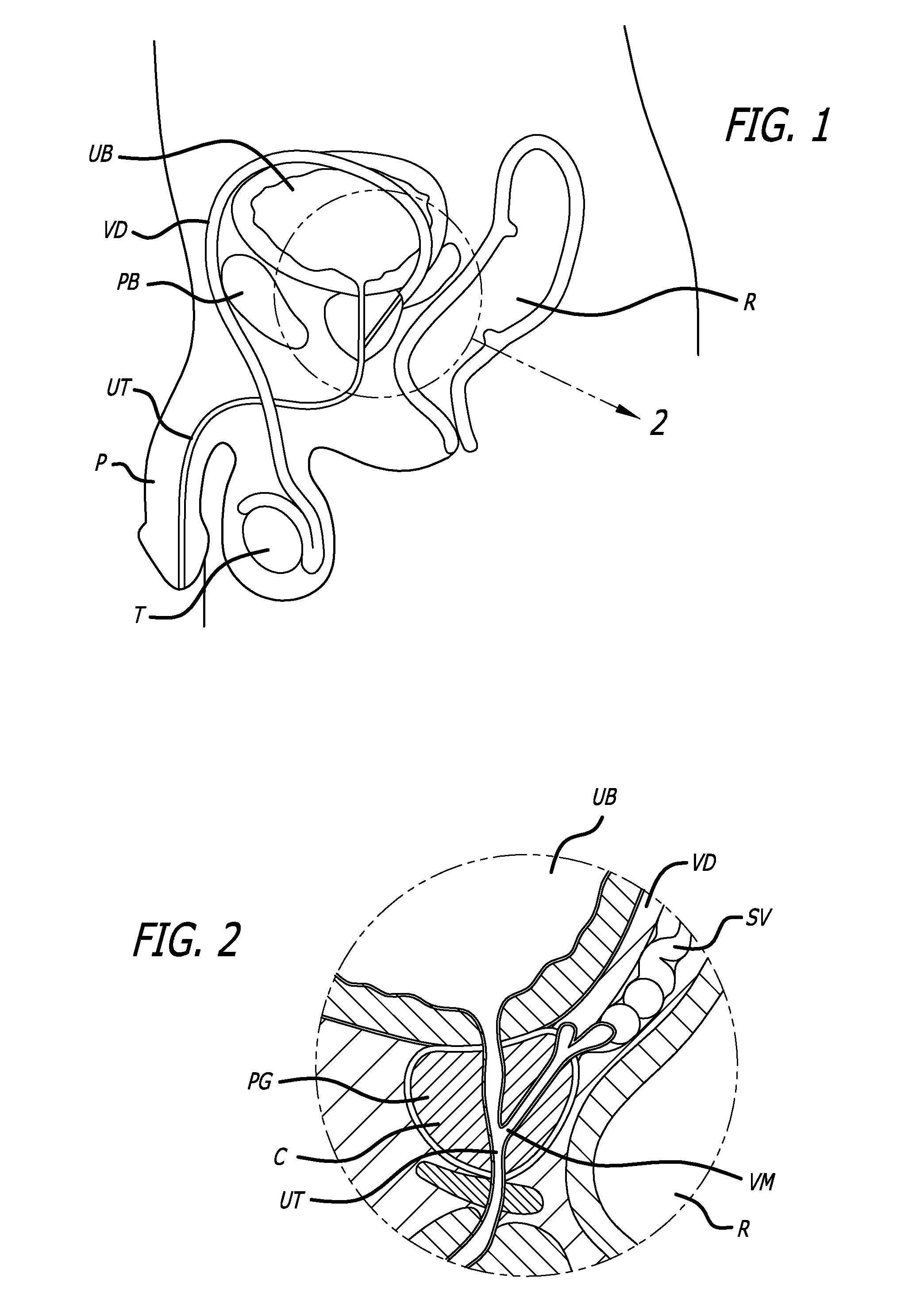 Continuous Indentation Lateral Lobe Apparatus and Method