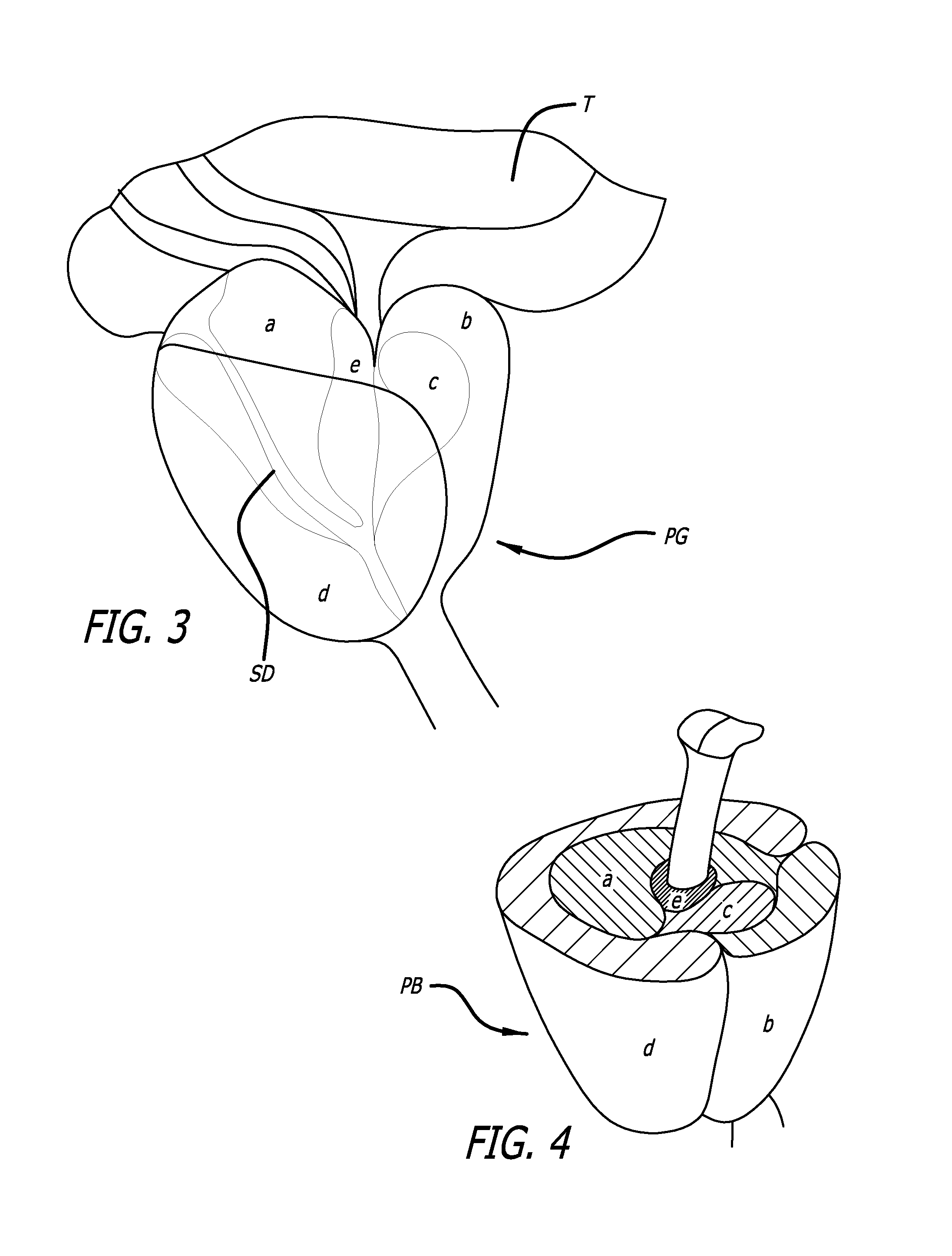 Continuous Indentation Lateral Lobe Apparatus and Method