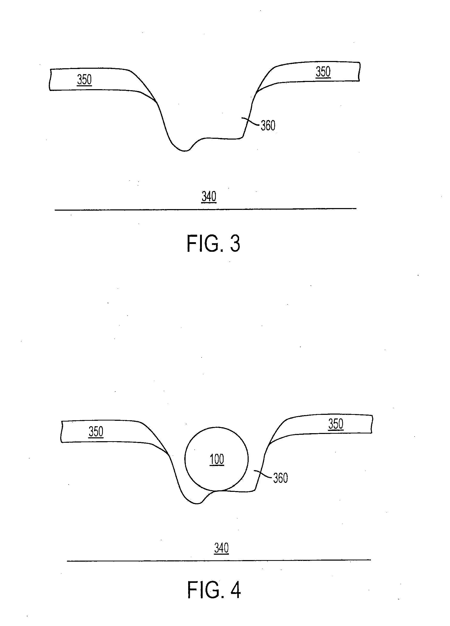 Implant pellets and methods for performing bone augmentation and preservation