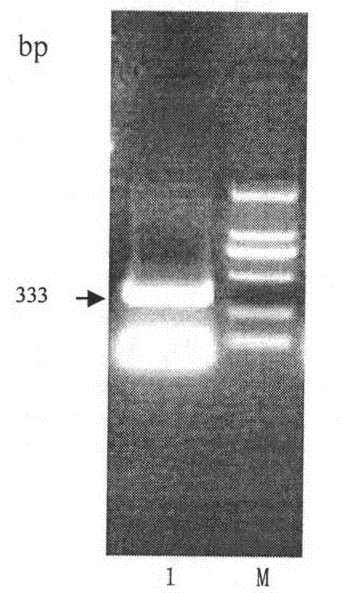 Modification of echinococcus granulosus EG95 protein, and expression thereof in yeast